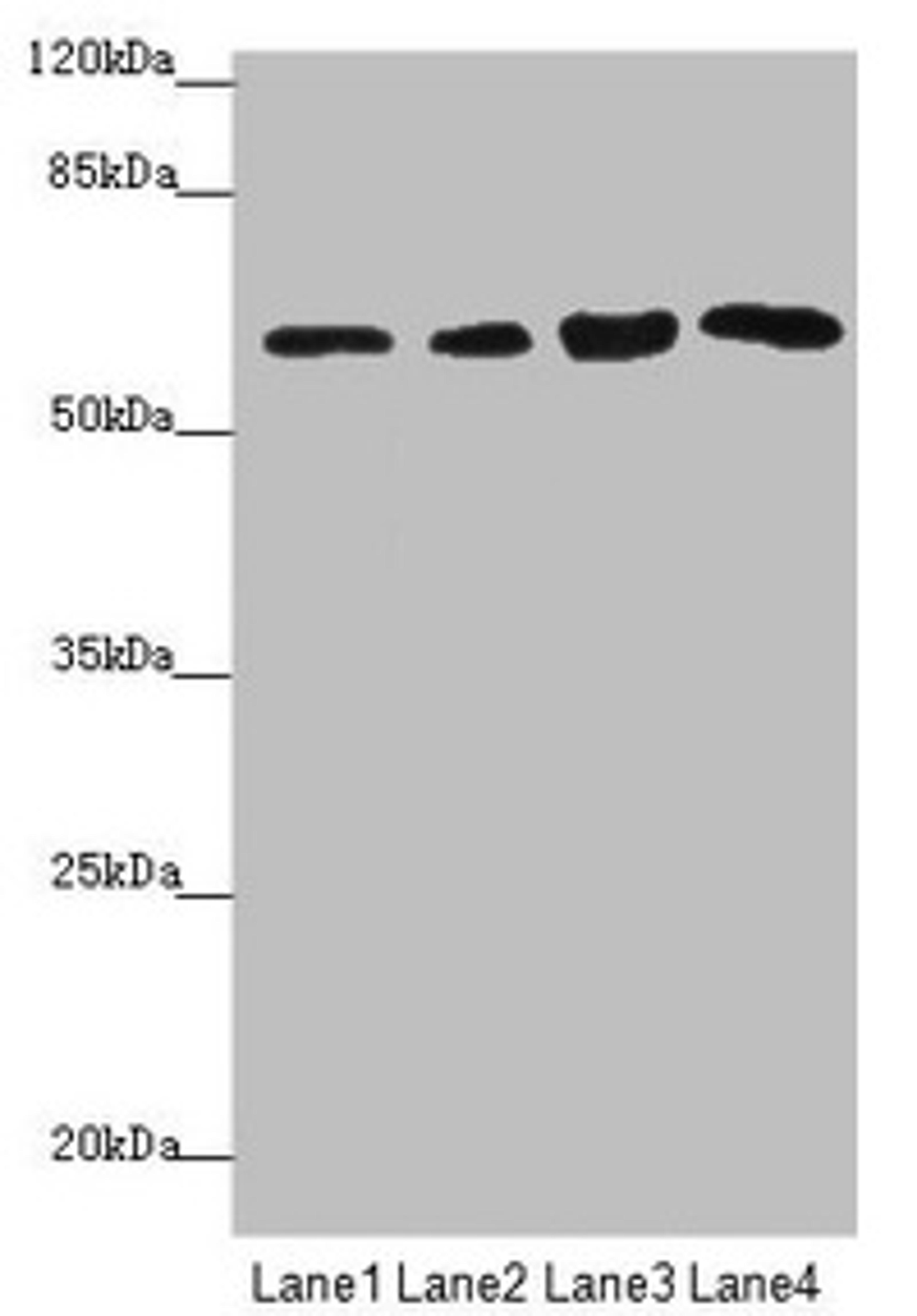 Western blot. All lanes: FBXO7 antibody at 3.97µg/ml. Lane 1: Mouse gonadal tissue. Lane 2: Jurkat whole cell lysate. Lane 3: 293T whole cell lysate. Lane 4: PC-3 whole cell lysate. Secondary. Goat polyclonal to rabbit IgG at 1/10000 dilution. Predicted band size: 59, 50, 46 kDa. Observed band size: 59 kDa