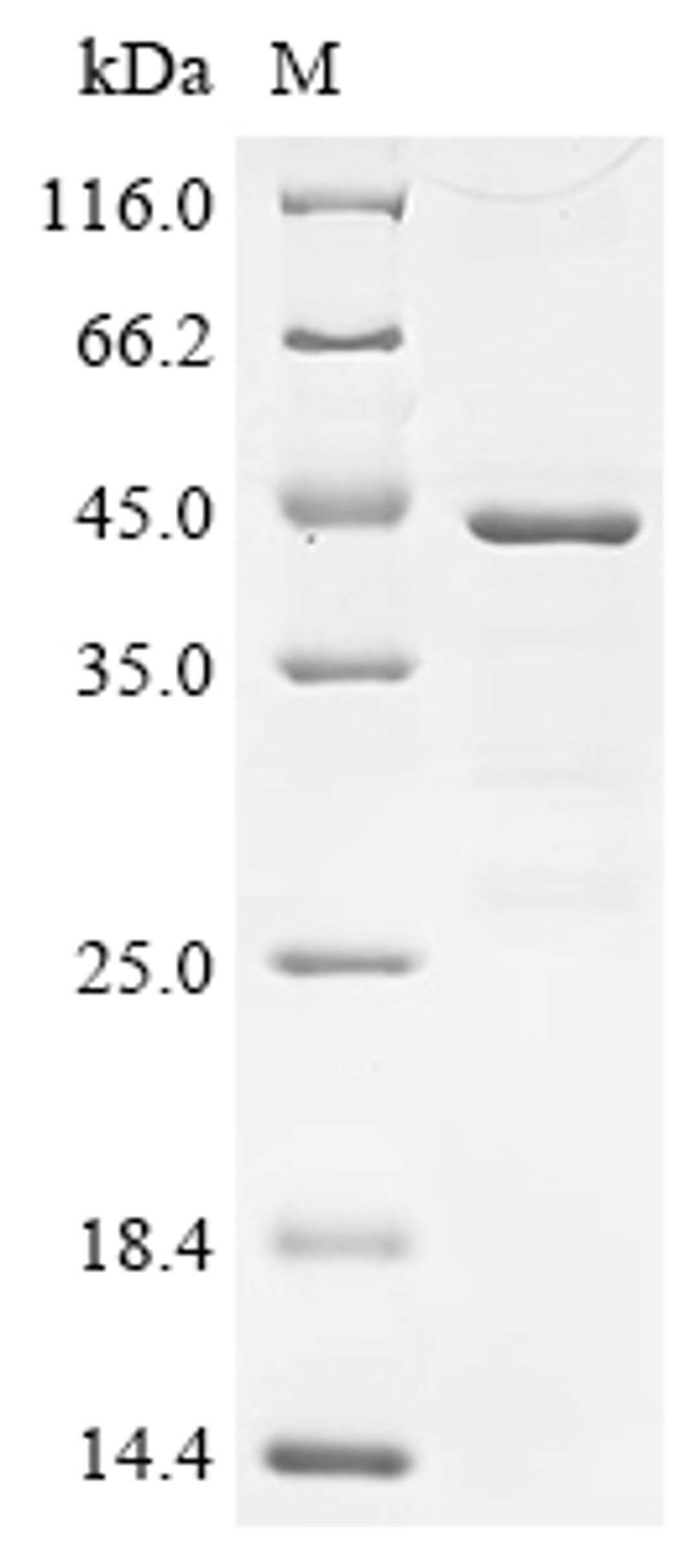 (Tris-Glycine gel) Discontinuous SDS-PAGE (reduced) with 5% enrichment gel and 15% separation gel.