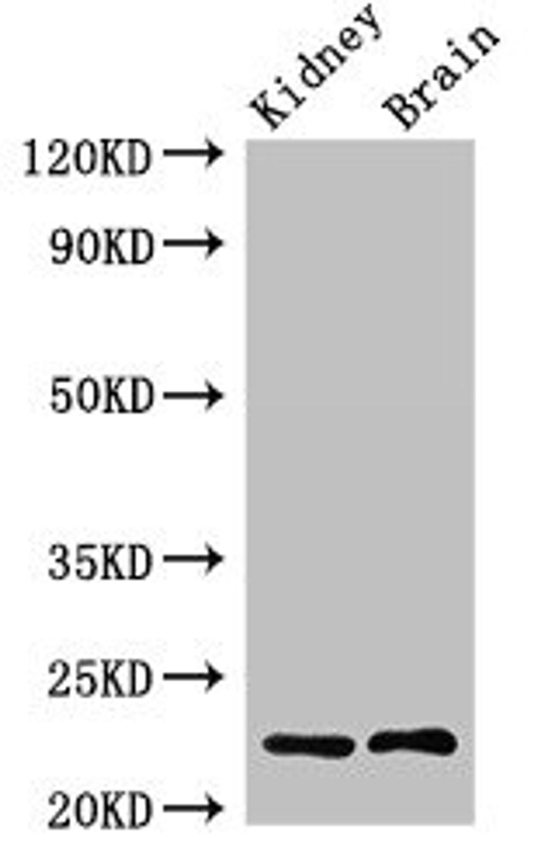Western Blot. Positive WB detected in: Rat kidney tissue, Mouse brain tissue. All lanes: CHP1 antibody at 2.4ug/ml. Secondary. Goat polyclonal to rabbit IgG at 1/50000 dilution. Predicted band size: 23 kDa. Observed band size: 23 kDa. 