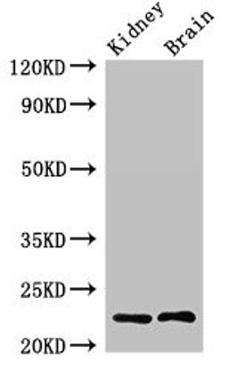 Western Blot. Positive WB detected in: Rat kidney tissue, Mouse brain tissue. All lanes: CHP1 antibody at 2.4ug/ml. Secondary. Goat polyclonal to rabbit IgG at 1/50000 dilution. Predicted band size: 23 kDa. Observed band size: 23 kDa. 