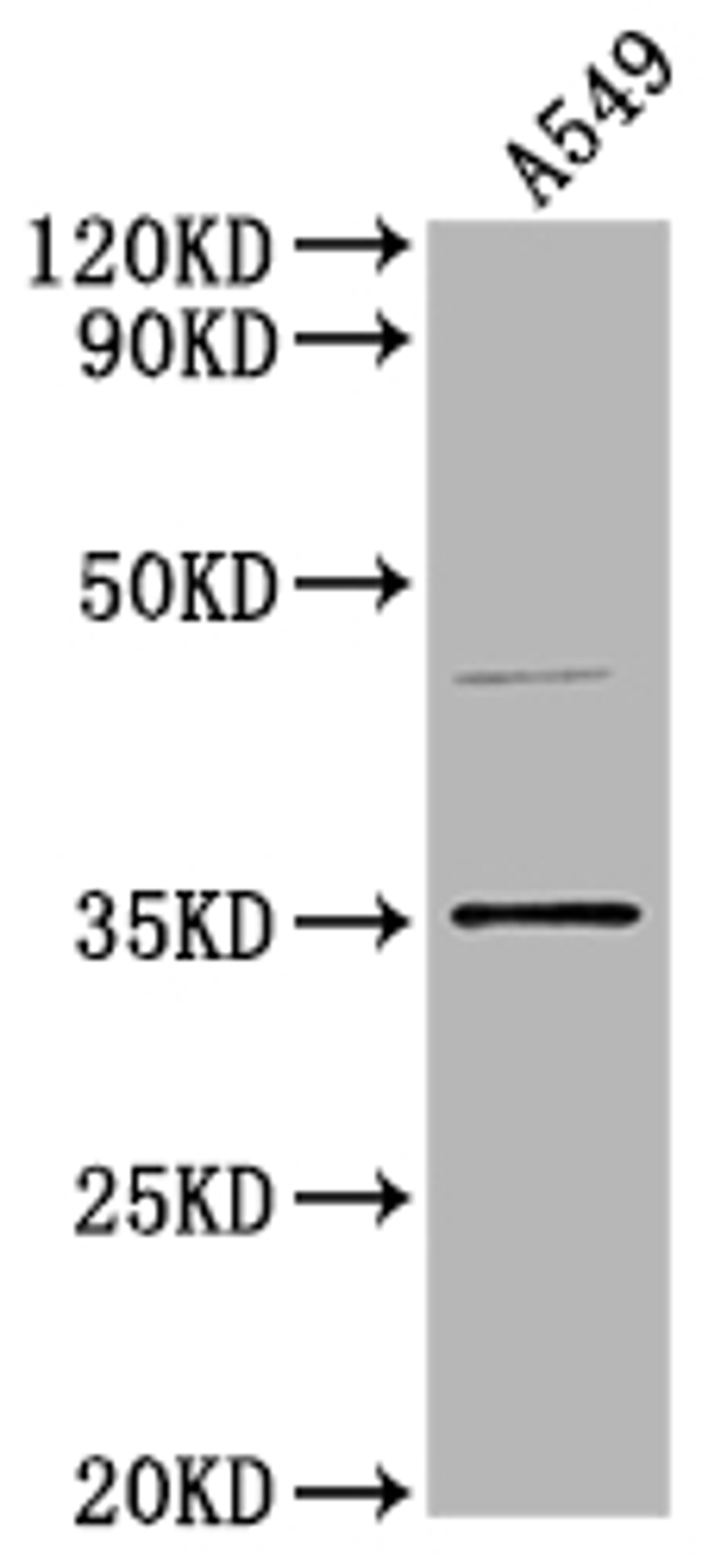 Western Blot. Positive WB detected in: A549 whole cell lysate. All lanes: OR5V1 antibody at 1:2000. Secondary. Goat polyclonal to rabbit IgG at 1/50000 dilution. Predicted band size: 37 kDa. Observed band size: 37 kDa. 
