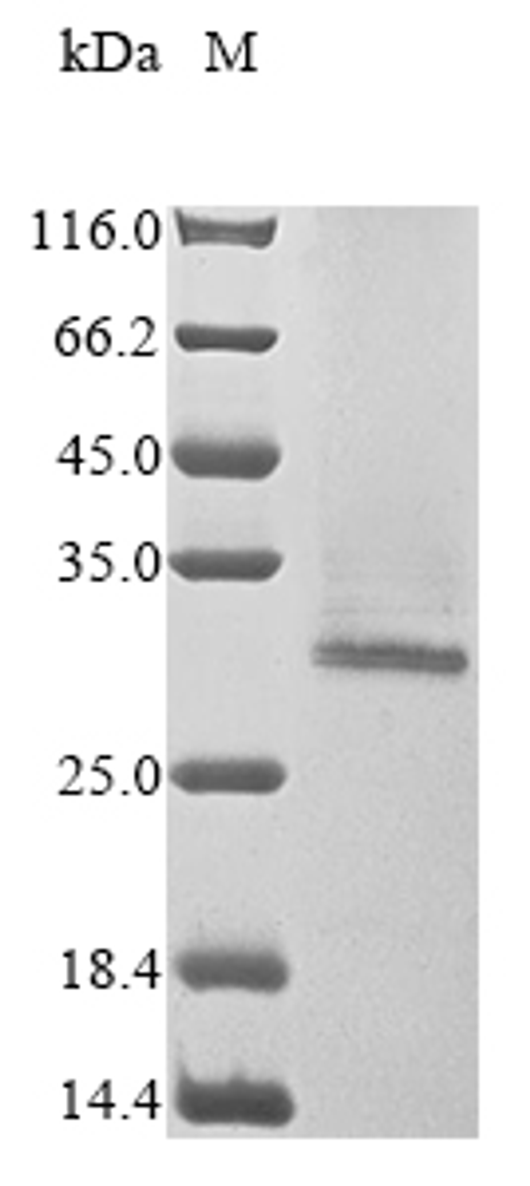 (Tris-Glycine gel) Discontinuous SDS-PAGE (reduced) with 5% enrichment gel and 15% separation gel.