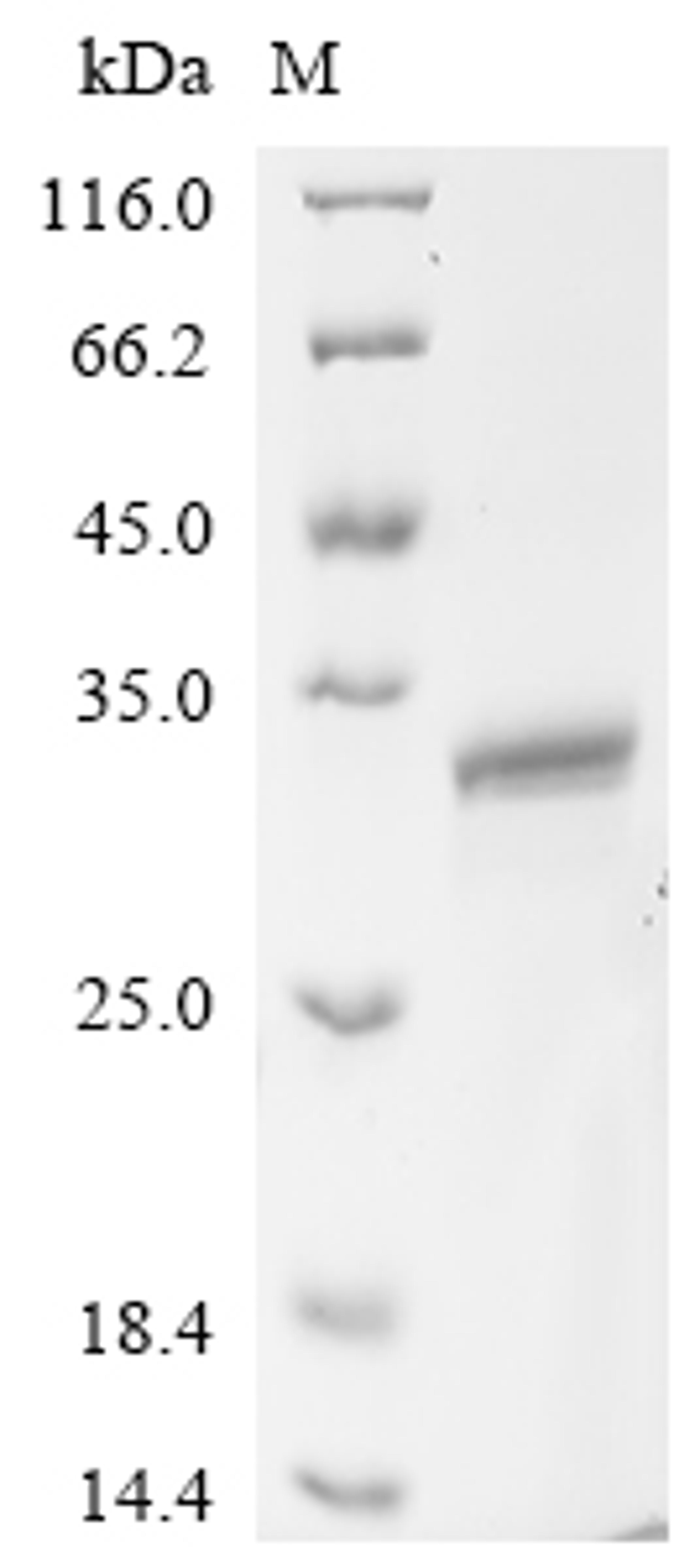 (Tris-Glycine gel) Discontinuous SDS-PAGE (reduced) with 5% enrichment gel and 15% separation gel.