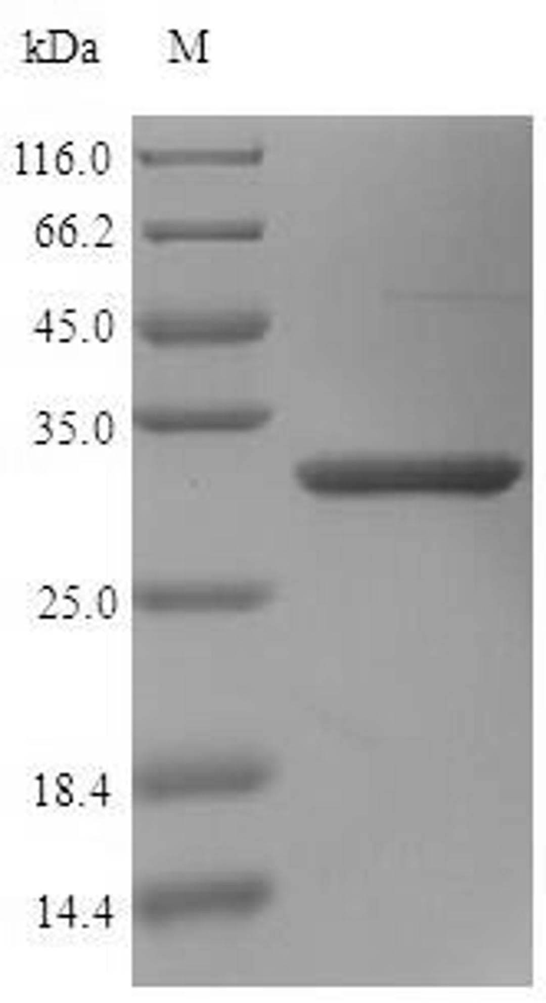 (Tris-Glycine gel) Discontinuous SDS-PAGE (reduced) with 5% enrichment gel and 15% separation gel.