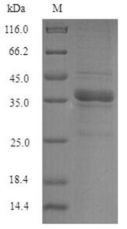 (Tris-Glycine gel) Discontinuous SDS-PAGE (reduced) with 5% enrichment gel and 15% separation gel.