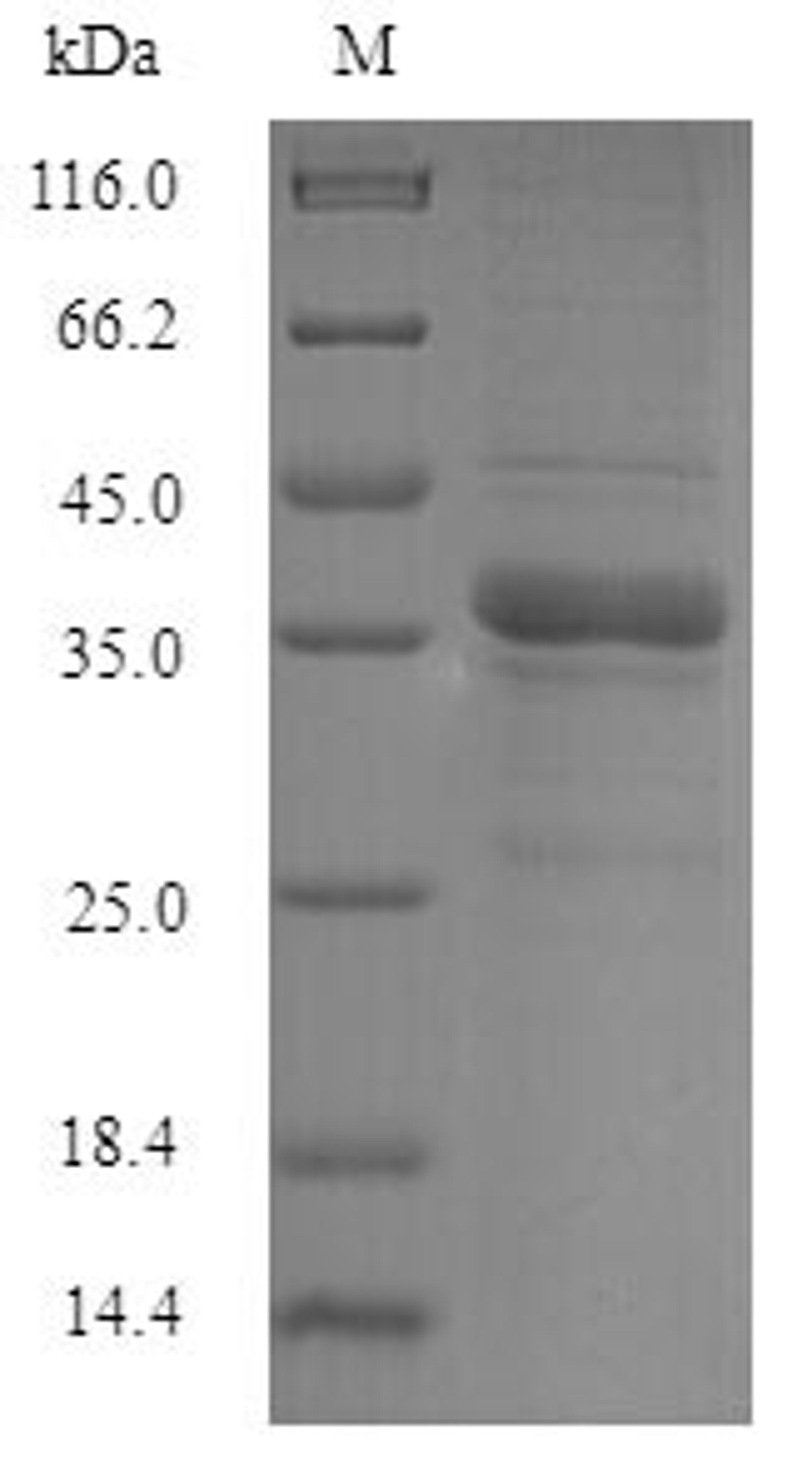 (Tris-Glycine gel) Discontinuous SDS-PAGE (reduced) with 5% enrichment gel and 15% separation gel.