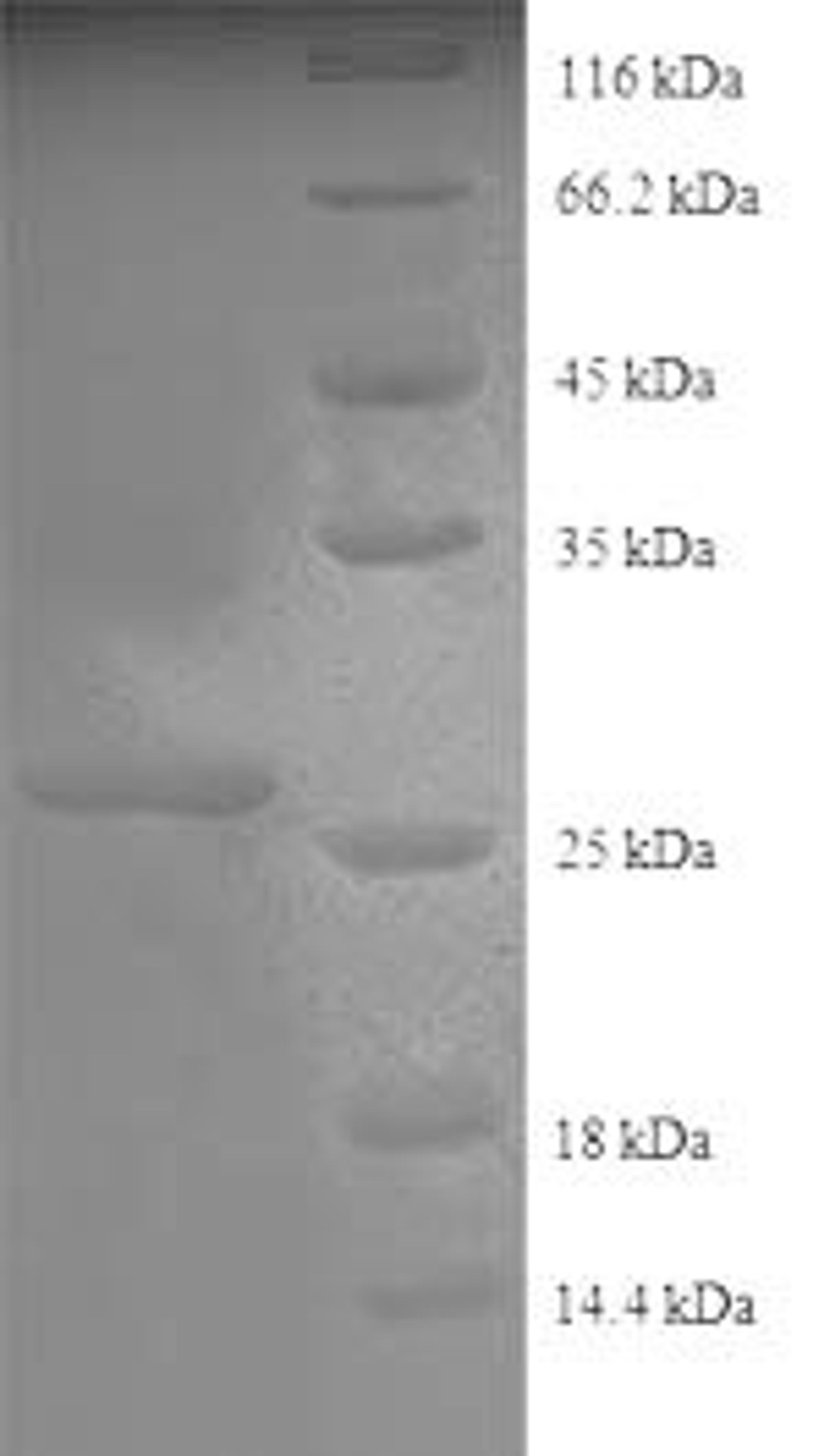 (Tris-Glycine gel) Discontinuous SDS-PAGE (reduced) with 5% enrichment gel and 15% separation gel.