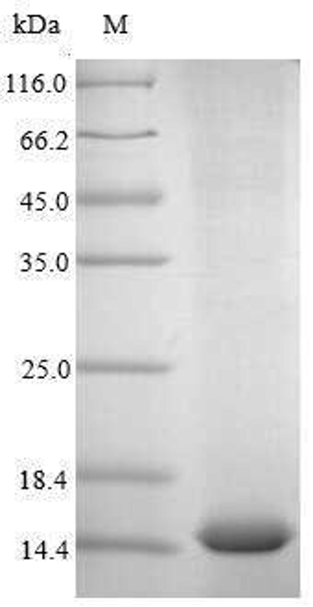 (Tris-Glycine gel) Discontinuous SDS-PAGE (reduced) with 5% enrichment gel and 15% separation gel.