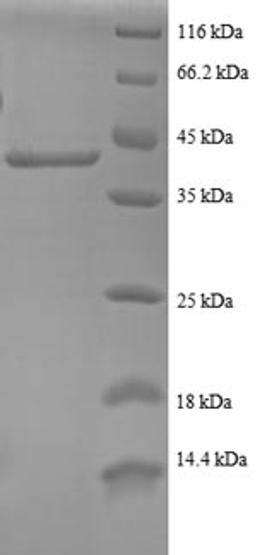 (Tris-Glycine gel) Discontinuous SDS-PAGE (reduced) with 5% enrichment gel and 15% separation gel.