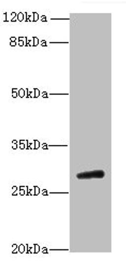 Western blot. All lanes: TBC1D26 antibody at 3µg/ml + Mouse liver tissue. Secondary. Goat polyclonal to rabbit IgG at 1/10000 dilution. Predicted band size: 29, 25, 10 kDa. Observed band size: 29 kDa