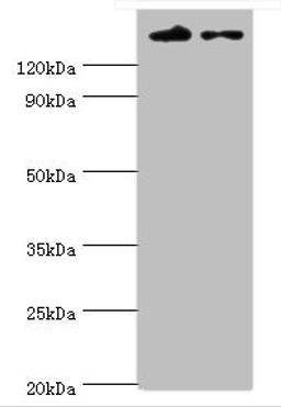 Western blot. All lanes: SETDB1 antibody at 5ug/ml. Lane 1: Rat adrenal gland tissue. Lane 2: 293T whole cell lysate. Secondary. Goat polyclonal to rabbit IgG at 1/10000 dilution. Predicted band size: 144, 45 kDa. Observed band size: 144 kDa. 