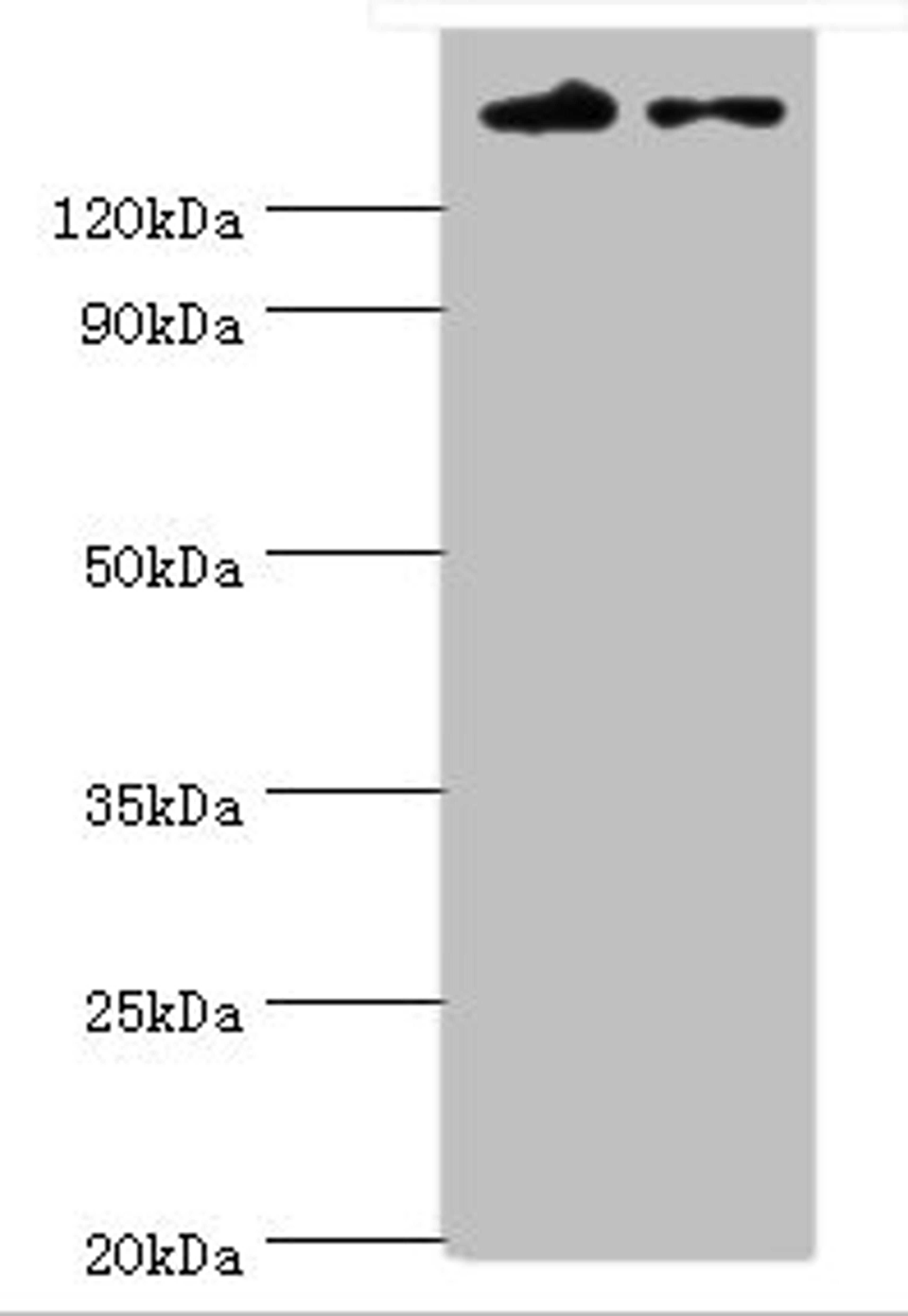 Western blot. All lanes: SETDB1 antibody at 5ug/ml. Lane 1: Rat adrenal gland tissue. Lane 2: 293T whole cell lysate. Secondary. Goat polyclonal to rabbit IgG at 1/10000 dilution. Predicted band size: 144, 45 kDa. Observed band size: 144 kDa. 