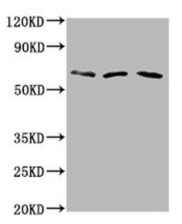 Western Blot. Positive WB detected in: Hela whole cell lysate, Rat brain tissue, Mouse brain tissue. All lanes: PHACTR1 antibody at 6µg/ml. Secondary. Goat polyclonal to rabbit IgG at 1/50000 dilution. Predicted band size: 67, 55 kDa. Observed band size: 67 kDa