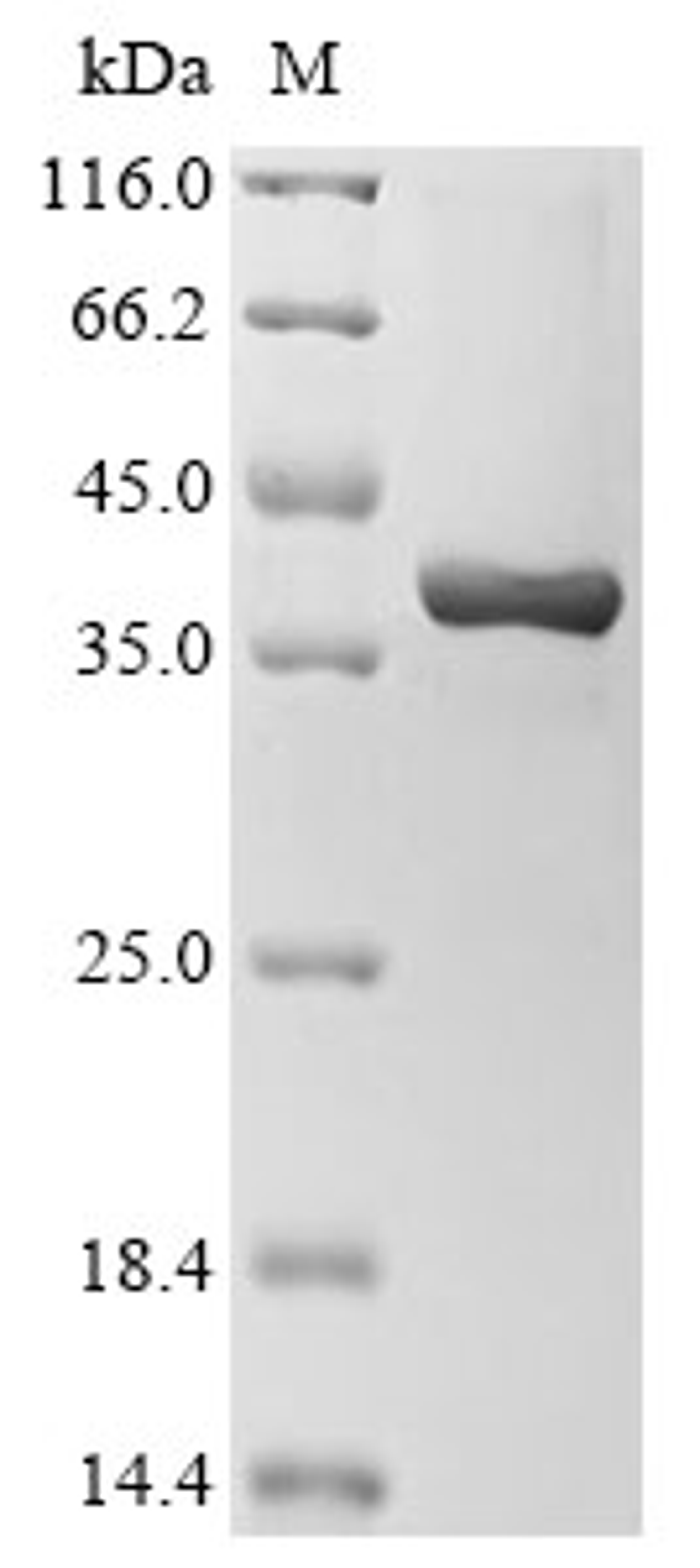 (Tris-Glycine gel) Discontinuous SDS-PAGE (reduced) with 5% enrichment gel and 15% separation gel.