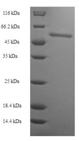 (Tris-Glycine gel) Discontinuous SDS-PAGE (reduced) with 5% enrichment gel and 15% separation gel.