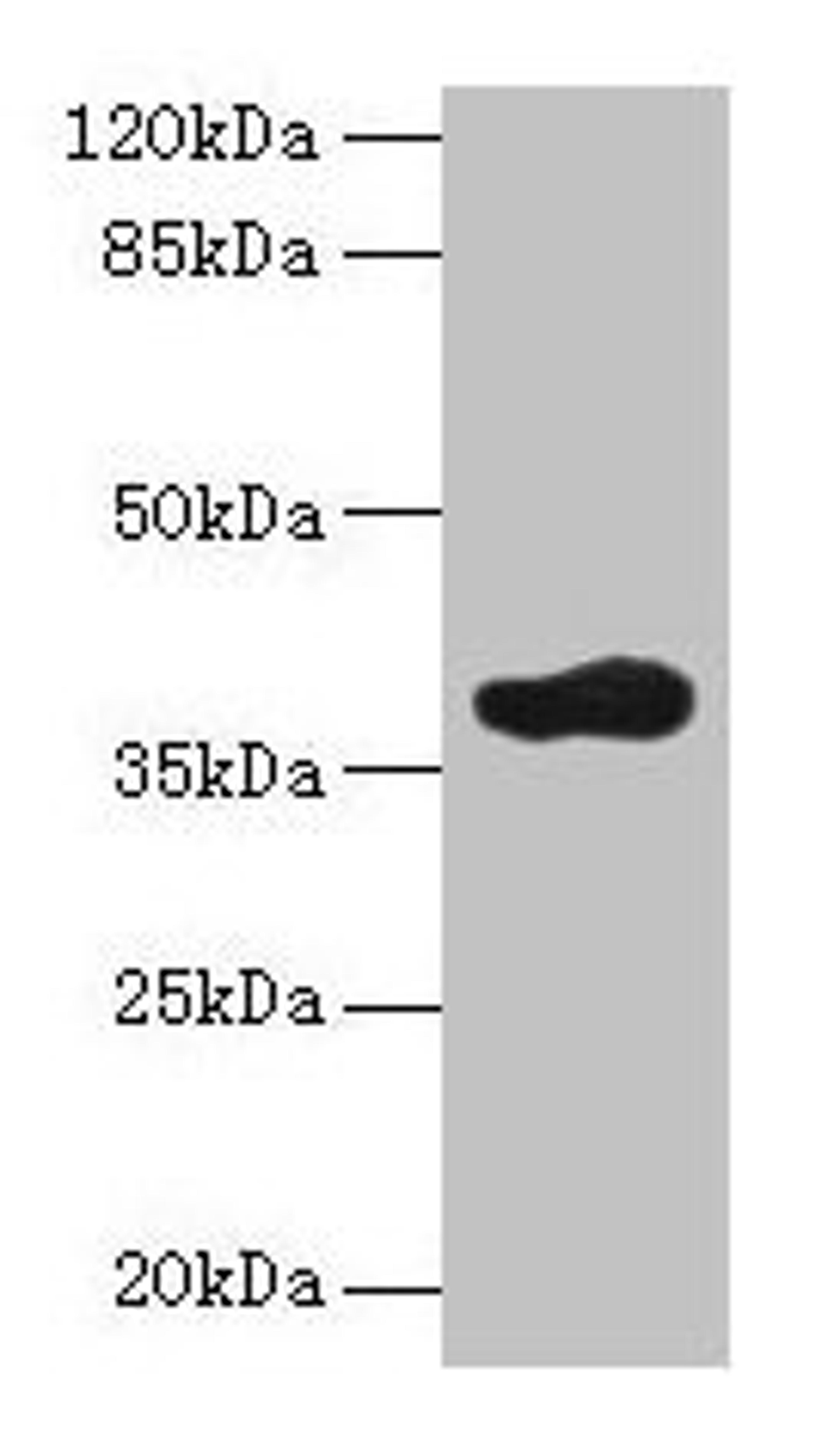 Western blot. All lanes: ARFIP2 antibody at 2µg/ml + Mouse brain tissue. Secondary. Goat polyclonal to rabbit IgG at 1/10000 dilution. Predicted band size: 38, 30, 34 kDa. Observed band size: 38 kDa