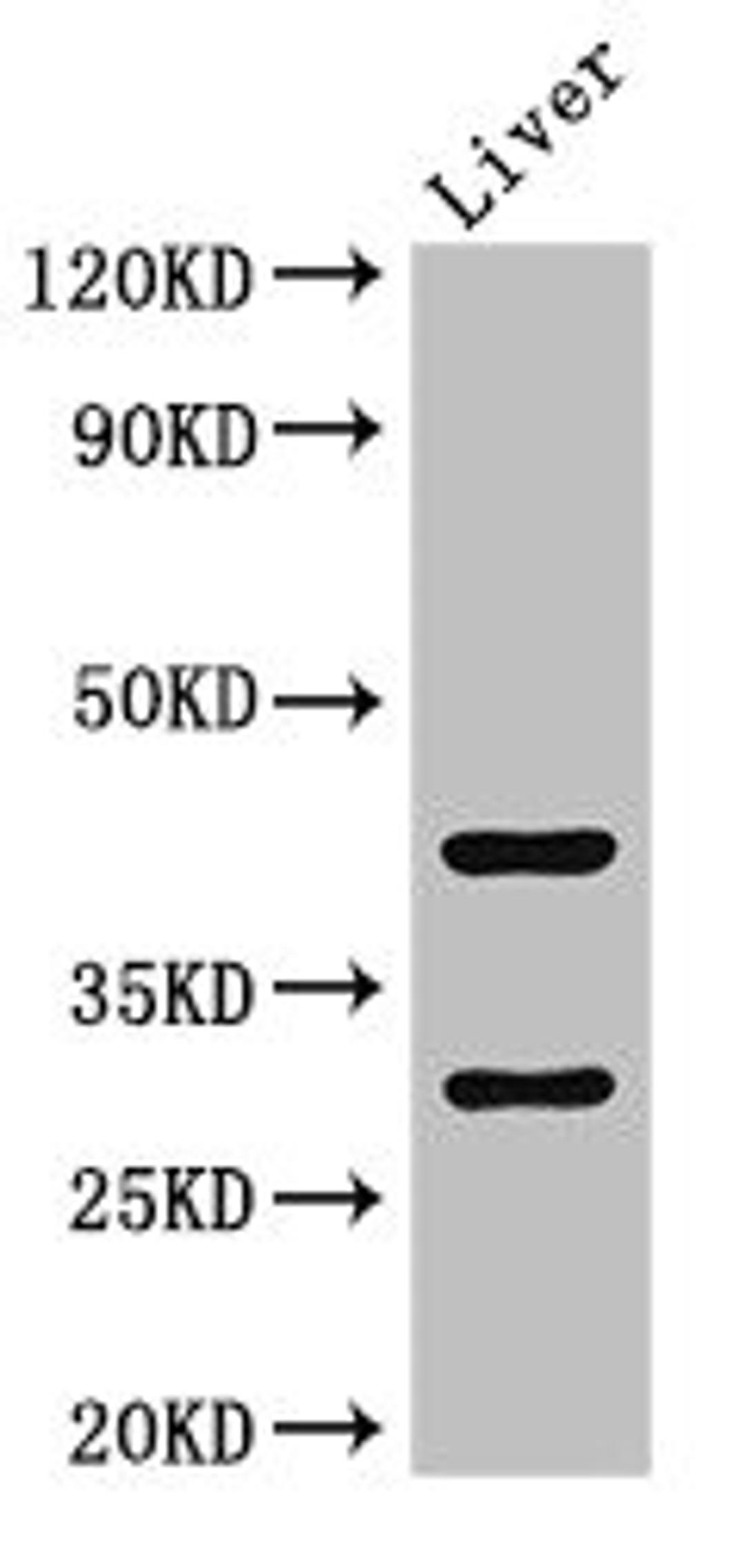 Western Blot. Positive WB detected in: Mouse liver tissue. All lanes: TIMD4 antibody at 2ug/ml. Secondary. Goat polyclonal to rabbit IgG at 1/50000 dilution. Predicted band size: 42, 39 kDa. Observed band size: 42, 30 kDa. 