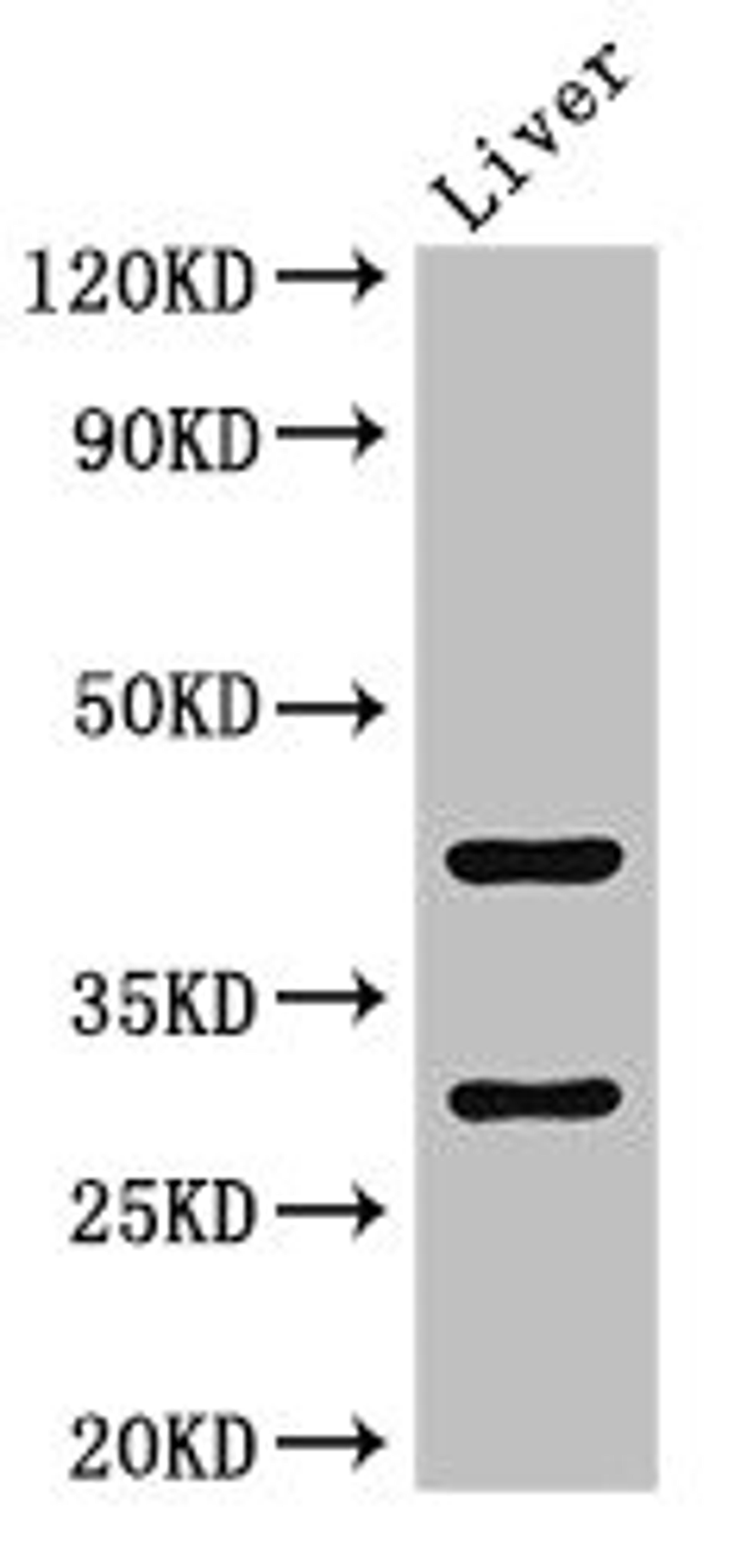 Western Blot. Positive WB detected in: Mouse liver tissue. All lanes: TIMD4 antibody at 2ug/ml. Secondary. Goat polyclonal to rabbit IgG at 1/50000 dilution. Predicted band size: 42, 39 kDa. Observed band size: 42, 30 kDa. 