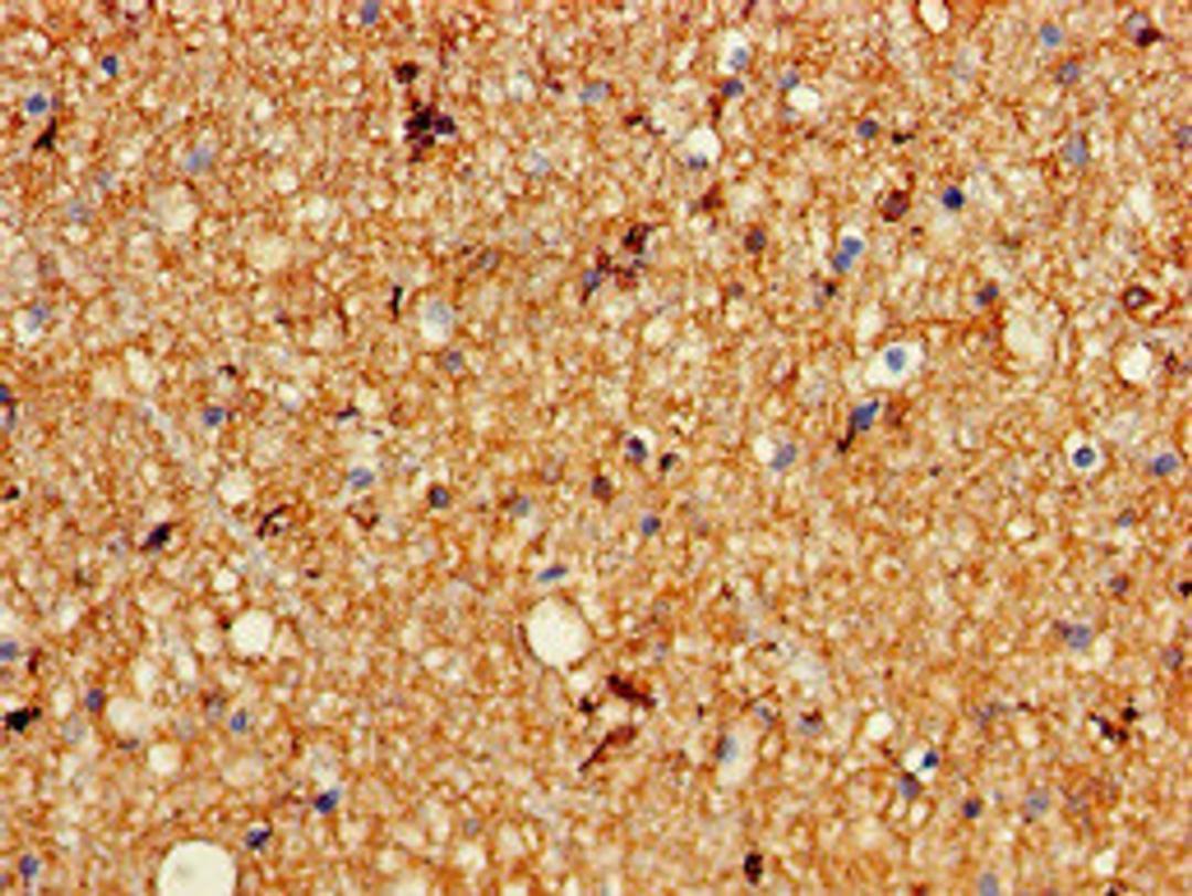 Immunohistochemistry of paraffin-embedded human brain tissue using CSB-PA012018LA01HU at dilution of 1:100