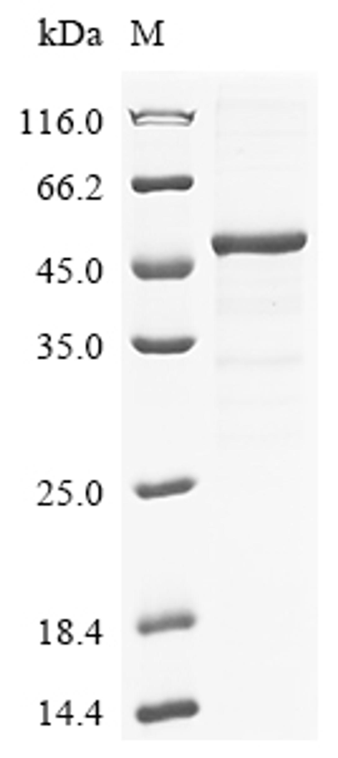 (Tris-Glycine gel) Discontinuous SDS-PAGE (reduced) with 5% enrichment gel and 15% separation gel.