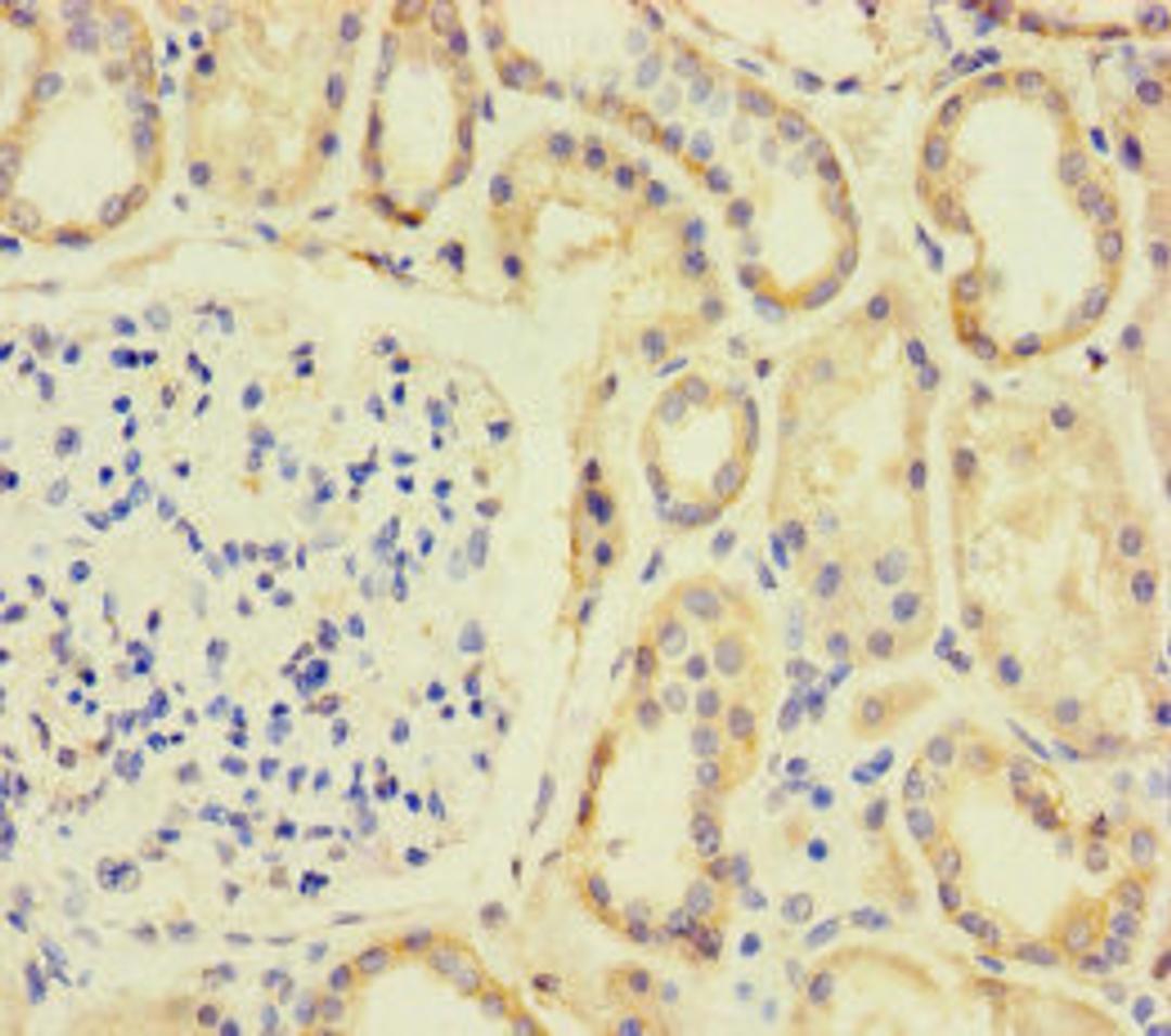 Immunohistochemistry of paraffin-embedded human kidney tissue using CSB-PA704087LA01HU at dilution of 1:100
