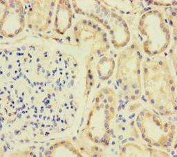 Immunohistochemistry of paraffin-embedded human kidney tissue using CSB-PA704087LA01HU at dilution of 1:100