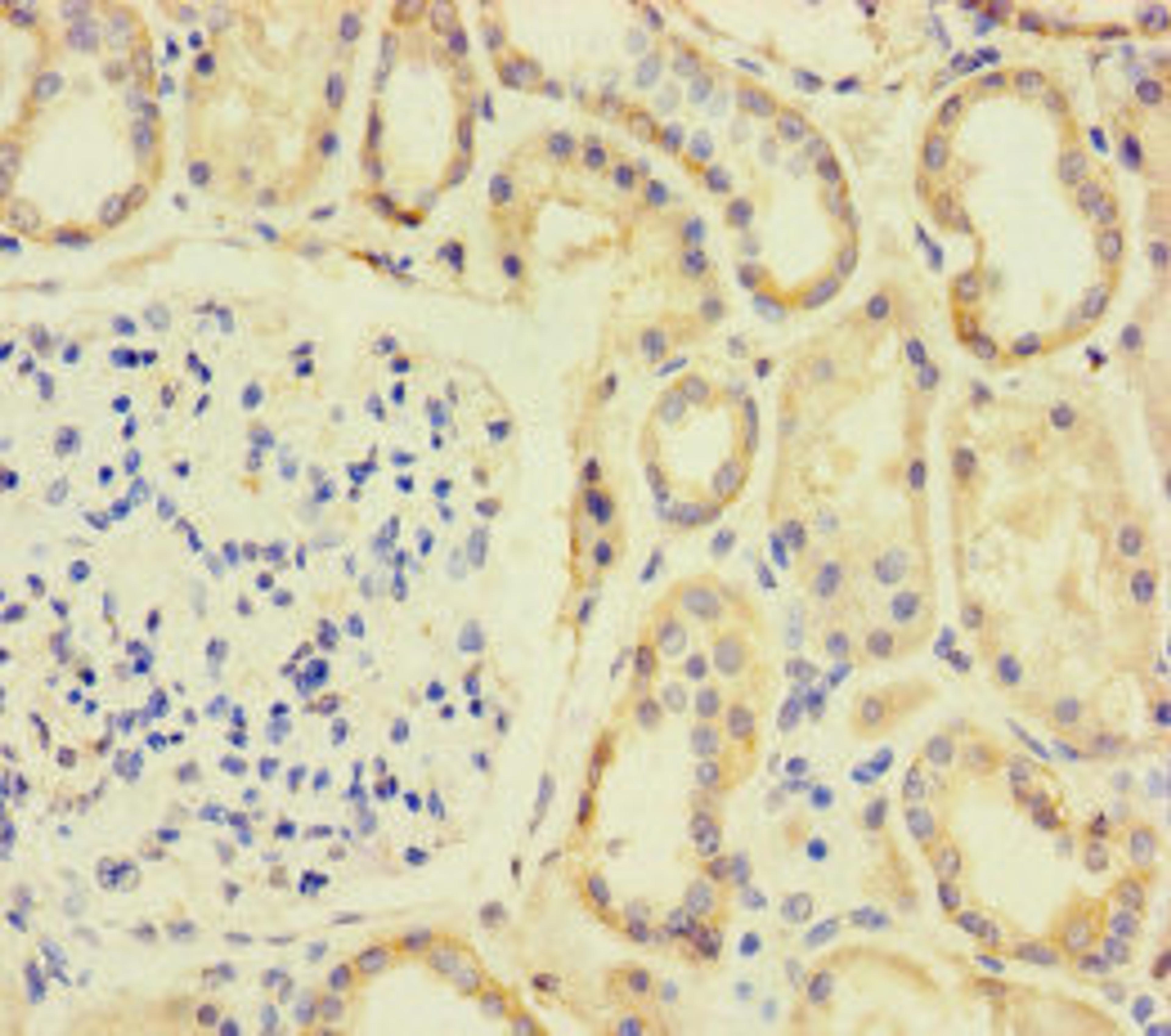 Immunohistochemistry of paraffin-embedded human kidney tissue using CSB-PA704087LA01HU at dilution of 1:100
