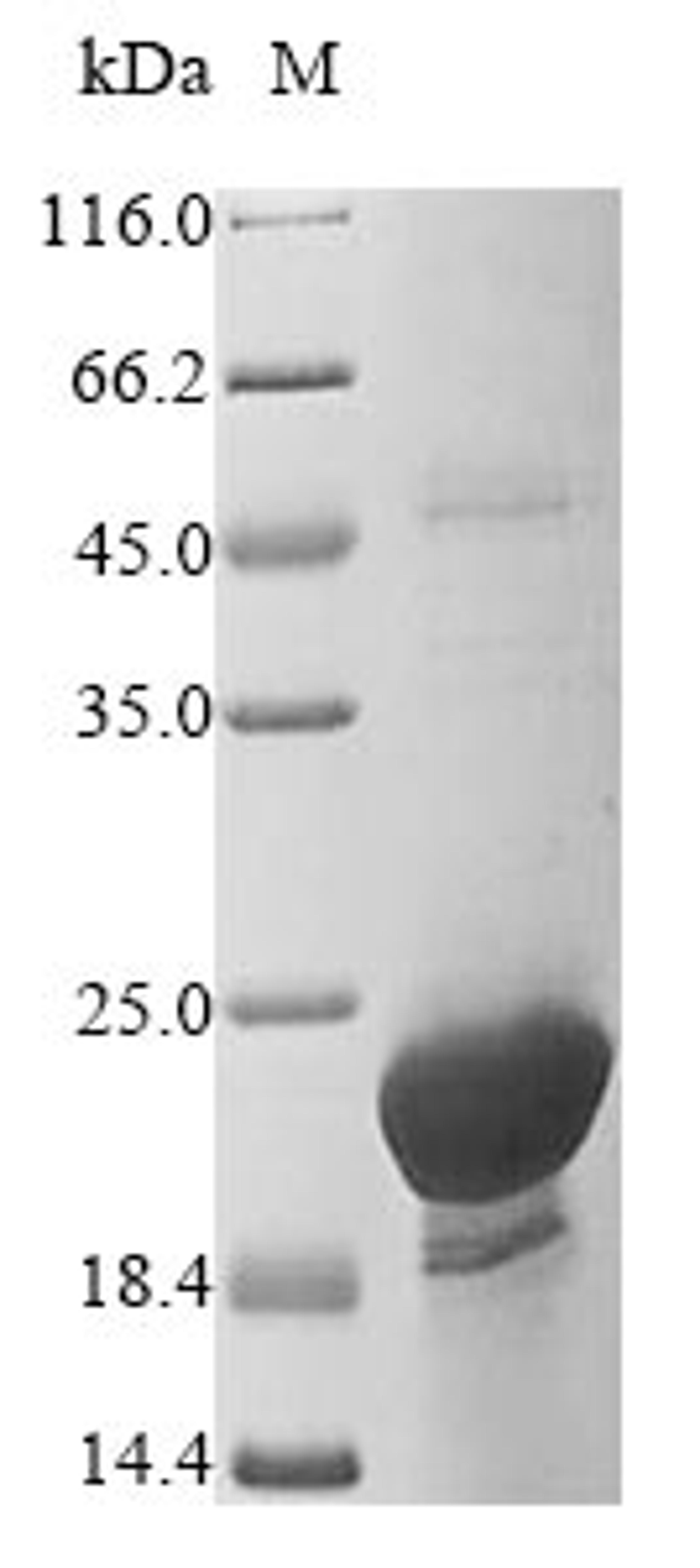 (Tris-Glycine gel) Discontinuous SDS-PAGE (reduced) with 5% enrichment gel and 15% separation gel.