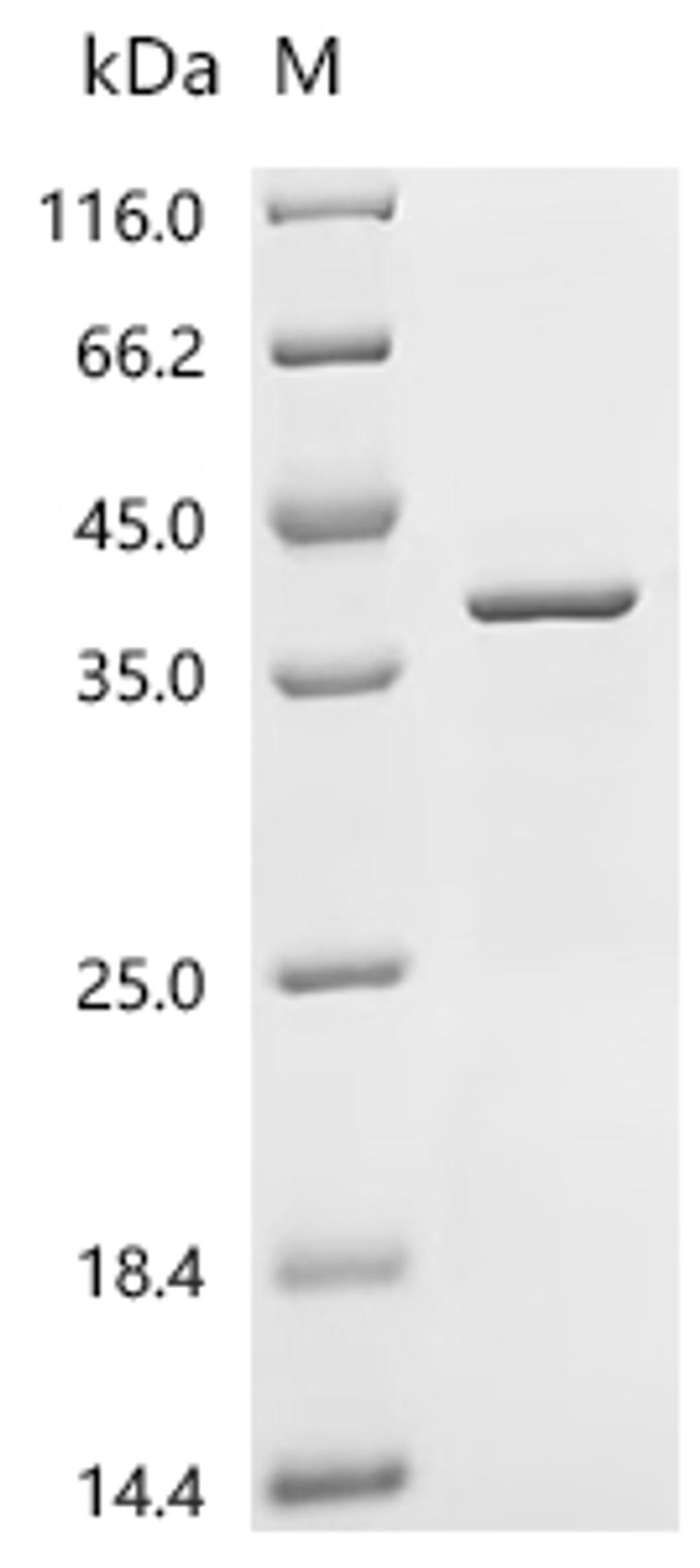 (Tris-Glycine gel) Discontinuous SDS-PAGE (reduced) with 5% enrichment gel and 15% separation gel.