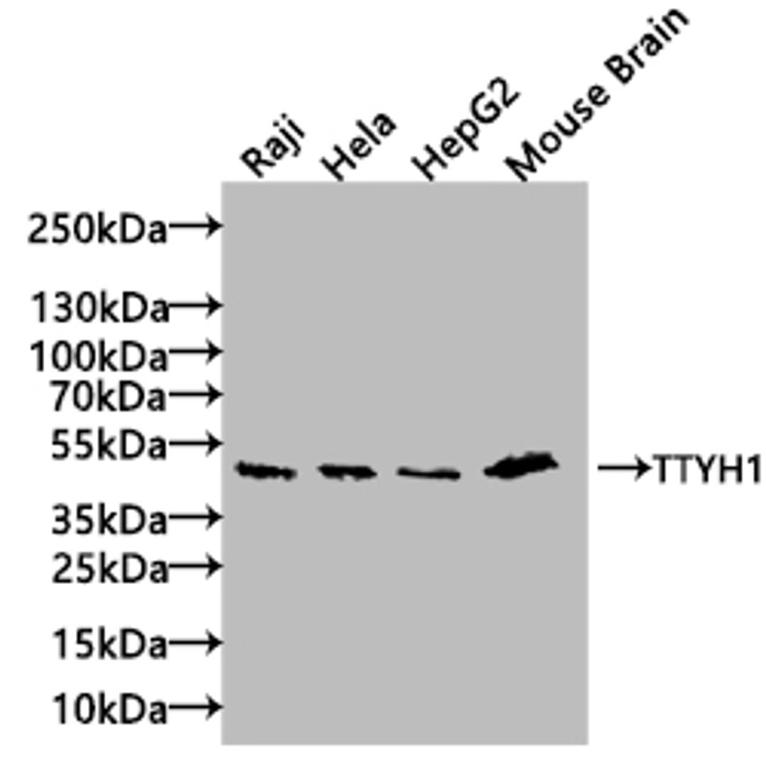 Western blot. All lanes: TTYH1 antibody at 4µg/ml + Raji whole cell lysate. Secondary. Goat polyclonal to rabbit IgG at 1/10000 dilution. Predicted band size: 50, 27, 36 kDa. Observed band size: 50 kDa