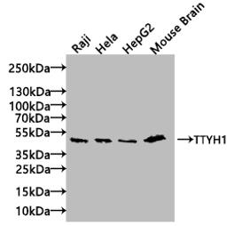 Western blot. All lanes: TTYH1 antibody at 4µg/ml + Raji whole cell lysate. Secondary. Goat polyclonal to rabbit IgG at 1/10000 dilution. Predicted band size: 50, 27, 36 kDa. Observed band size: 50 kDa