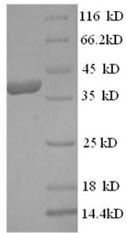 (Tris-Glycine gel) Discontinuous SDS-PAGE (reduced) with 5% enrichment gel and 15% separation gel.