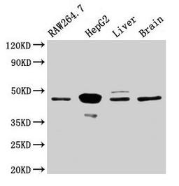 Western Blot. Positive WB detected in: RAW264.7 whole cell lysate, HepG2 whole cell lysate, Rat liver tissue, Mouse brain tissue. All lanes: Map2k4 antibody at 3.2µg/ml. Secondary. Goat polyclonal to rabbit IgG at 1/50000 dilution. Predicted band size: 45 kDa. Observed band size: 45 kDa