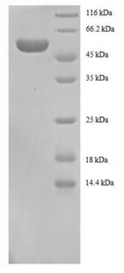 (Tris-Glycine gel) Discontinuous SDS-PAGE (reduced) with 5% enrichment gel and 15% separation gel.