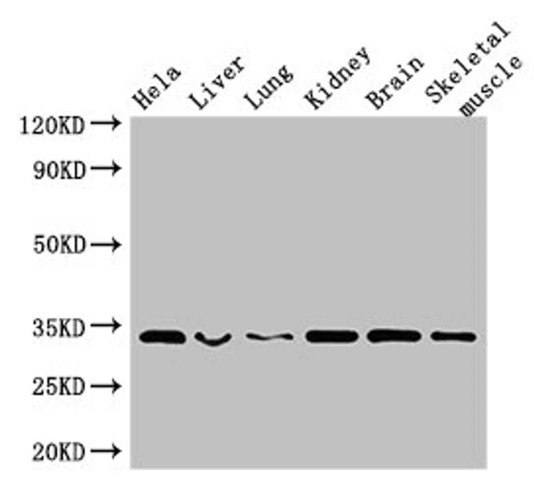 Western Blot. Positive WB detected in: Hela whole cell lysate, Mouse liver tissue, Mouse lung tissue, Mouse kidney tissue, Mouse brain tissue, Mouse skeletal muscle tissue. All lanes: CNN2 antibody at 2.5µg/ml. Secondary. Goat polyclonal to rabbit IgG at 1/50000 dilution. Predicted band size: 34, 30 kDa. Observed band size: 34 kDa