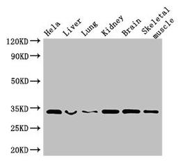 Western Blot. Positive WB detected in: Hela whole cell lysate, Mouse liver tissue, Mouse lung tissue, Mouse kidney tissue, Mouse brain tissue, Mouse skeletal muscle tissue. All lanes: CNN2 antibody at 2.5µg/ml. Secondary. Goat polyclonal to rabbit IgG at 1/50000 dilution. Predicted band size: 34, 30 kDa. Observed band size: 34 kDa