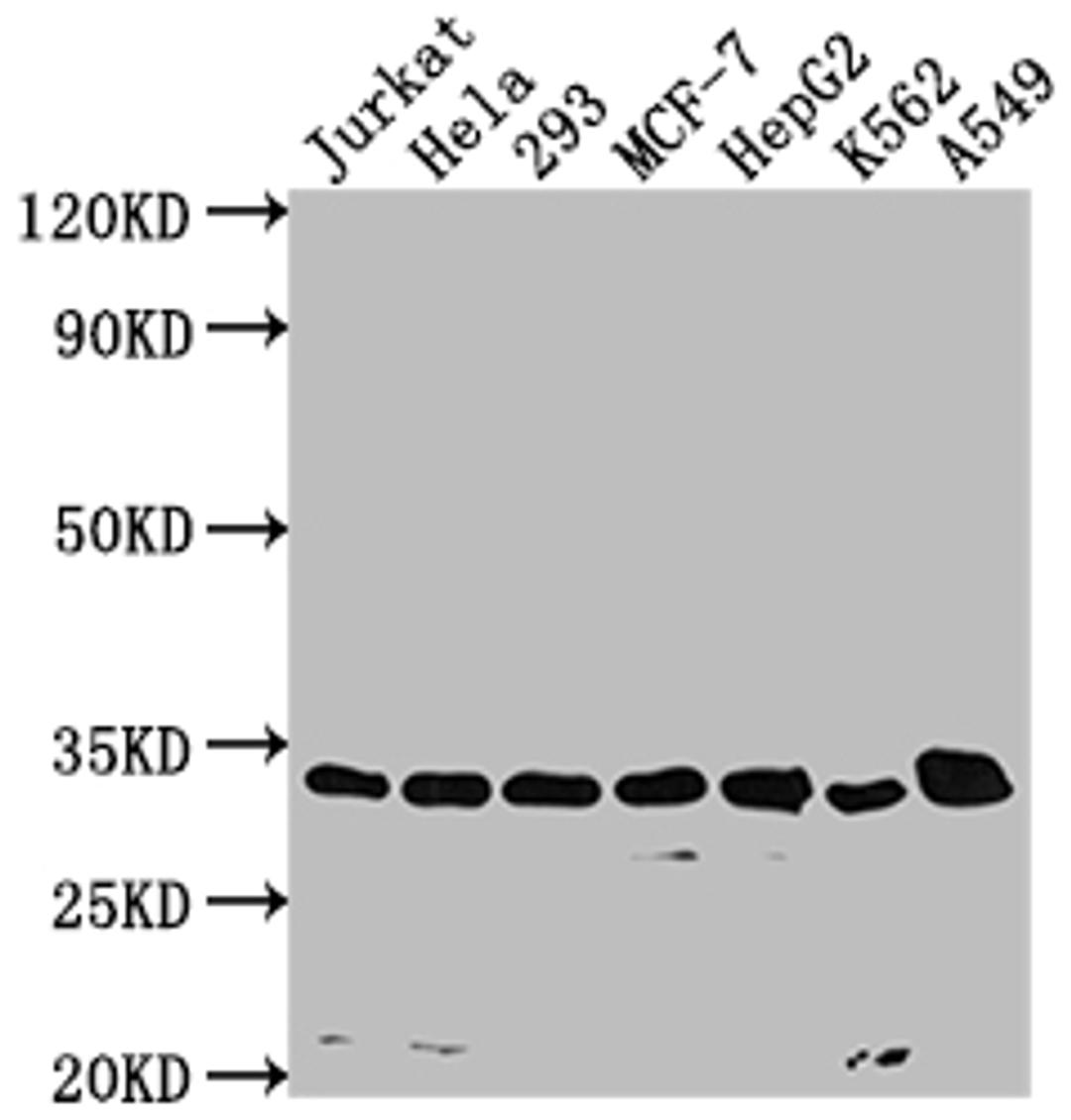 Western Blot. Positive WB detected in: Jurkat whole cell lysate, Hela whole cell lysate, 293 whole cell lysate, MCF-7 whole cell lysate, HepG2 whole cell lysate, K562 whole cell lysate, A549 whole cell lysate. All lanes: CDK4 antibody at 1:1500. Secondary. Goat polyclonal to rabbit IgG at 1/50000 dilution. Predicted band size: 34, 21 kDa. Observed band size: 34 kDa. 
