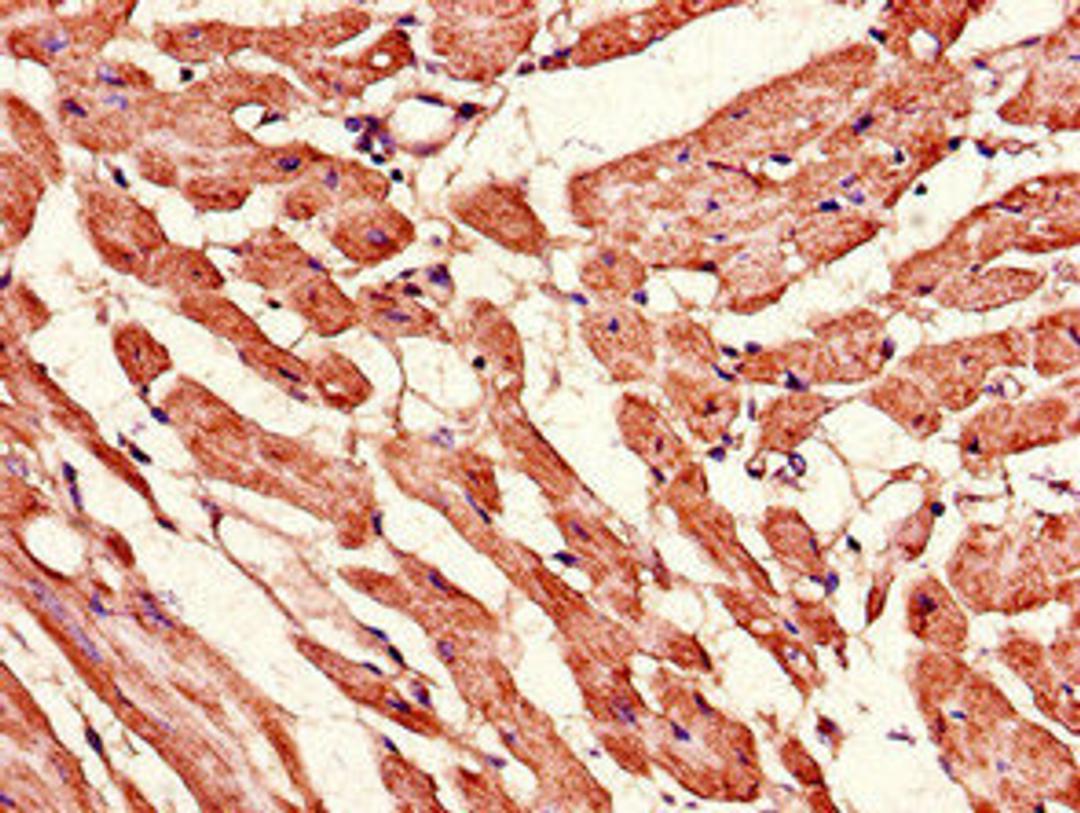 Immunohistochemistry of paraffin-embedded human heart tissue using CSB-PA013756LA01HU at dilution of 1:100