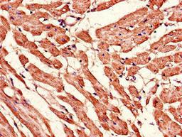 Immunohistochemistry of paraffin-embedded human heart tissue using CSB-PA013756LA01HU at dilution of 1:100