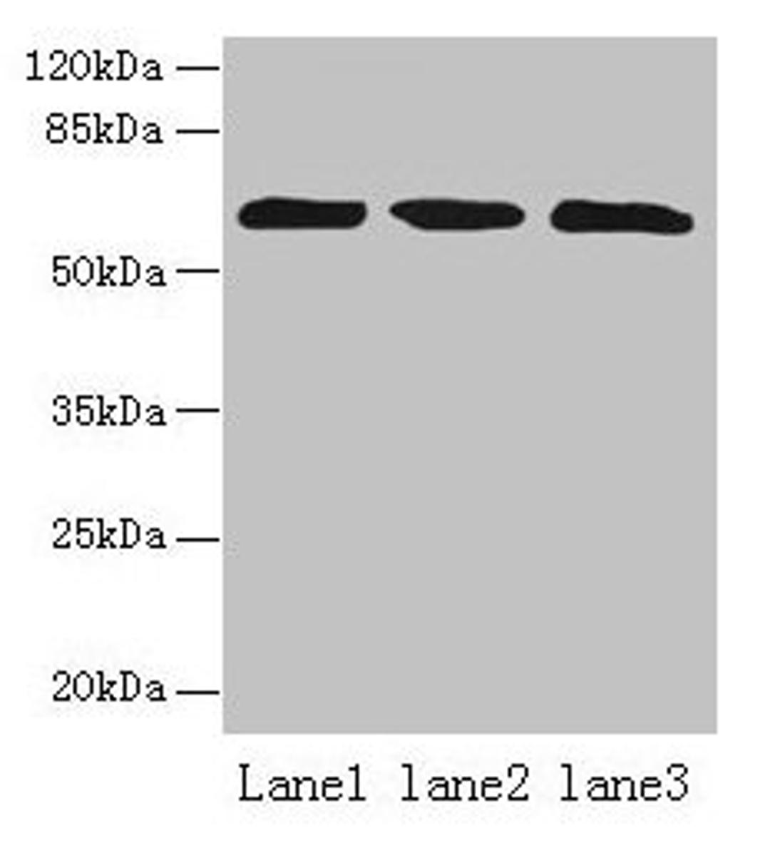 Western blot. All lanes: ZNF554 antibody at 5µg/ml. Lane 1: K562 whole cell lysate. Lane 2: U937 whole cell lysate. Lane 3: A549 whole cell lysate. Secondary. Goat polyclonal to rabbit IgG at 1/10000 dilution. Predicted band size: 61 kDa. Observed band size: 61 kDa