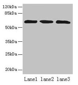 Western blot. All lanes: ZNF554 antibody at 5µg/ml. Lane 1: K562 whole cell lysate. Lane 2: U937 whole cell lysate. Lane 3: A549 whole cell lysate. Secondary. Goat polyclonal to rabbit IgG at 1/10000 dilution. Predicted band size: 61 kDa. Observed band size: 61 kDa
