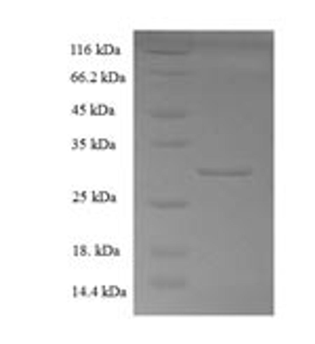 (Tris-Glycine gel) Discontinuous SDS-PAGE (reduced) with 5% enrichment gel and 15% separation gel.