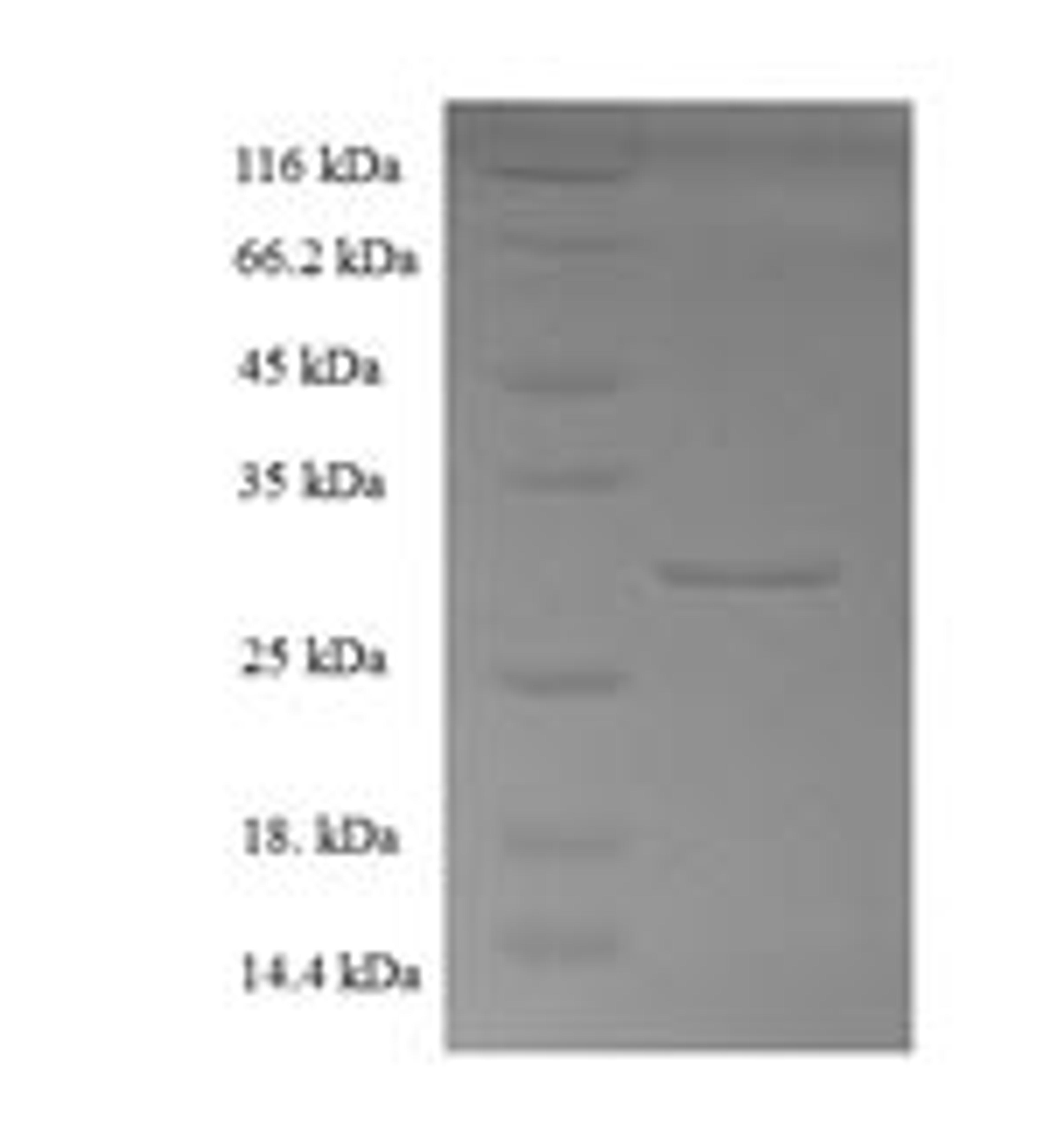 (Tris-Glycine gel) Discontinuous SDS-PAGE (reduced) with 5% enrichment gel and 15% separation gel.