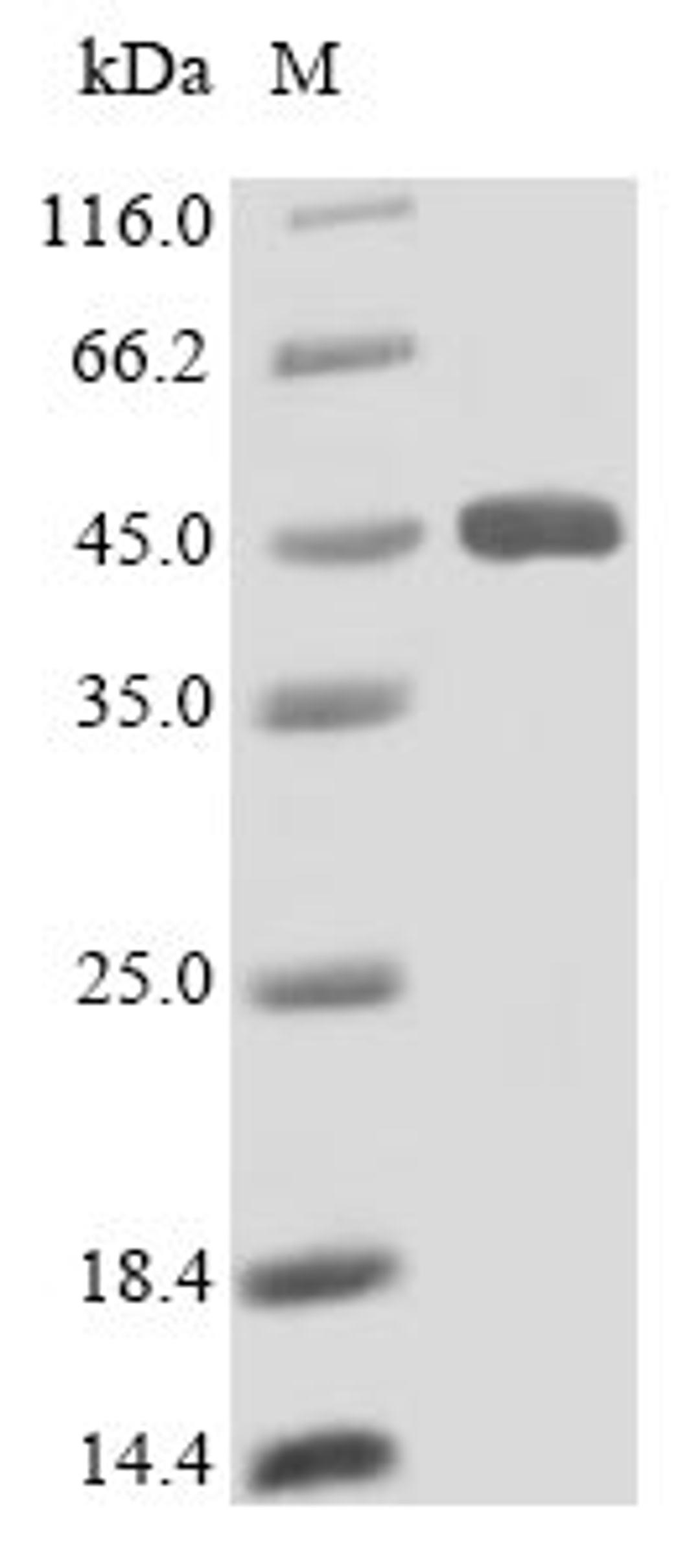 (Tris-Glycine gel) Discontinuous SDS-PAGE (reduced) with 5% enrichment gel and 15% separation gel.