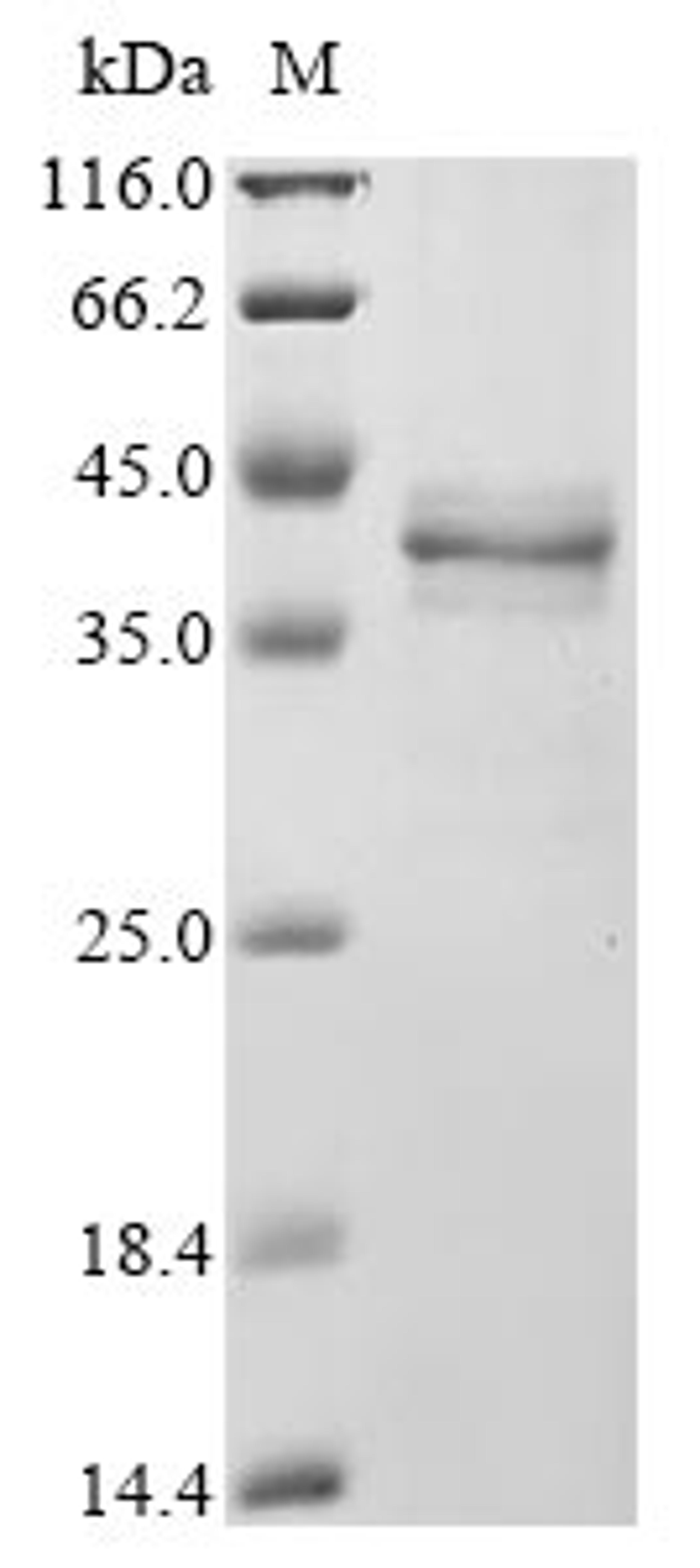 (Tris-Glycine gel) Discontinuous SDS-PAGE (reduced) with 5% enrichment gel and 15% separation gel.