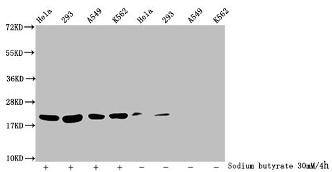 Western Blot. Detected samples: Hela whole cell lysate, 293 whole cell lysate, A549 whole cell lysate, K562 whole cell lysate; Untreated (-) or treated (+) with 30mM sodium butyrate for 4h. All lanes: HIST1H1C antibody at 1:100. Secondary. Goat polyclonal to rabbit IgG at 1/50000 dilution. Predicted band size: 22 kDa. Observed band size: 22 kDa
