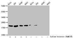 Western Blot. Detected samples: Hela whole cell lysate, 293 whole cell lysate, A549 whole cell lysate, K562 whole cell lysate; Untreated (-) or treated (+) with 30mM sodium butyrate for 4h. All lanes: HIST1H1C antibody at 1:100. Secondary. Goat polyclonal to rabbit IgG at 1/50000 dilution. Predicted band size: 22 kDa. Observed band size: 22 kDa