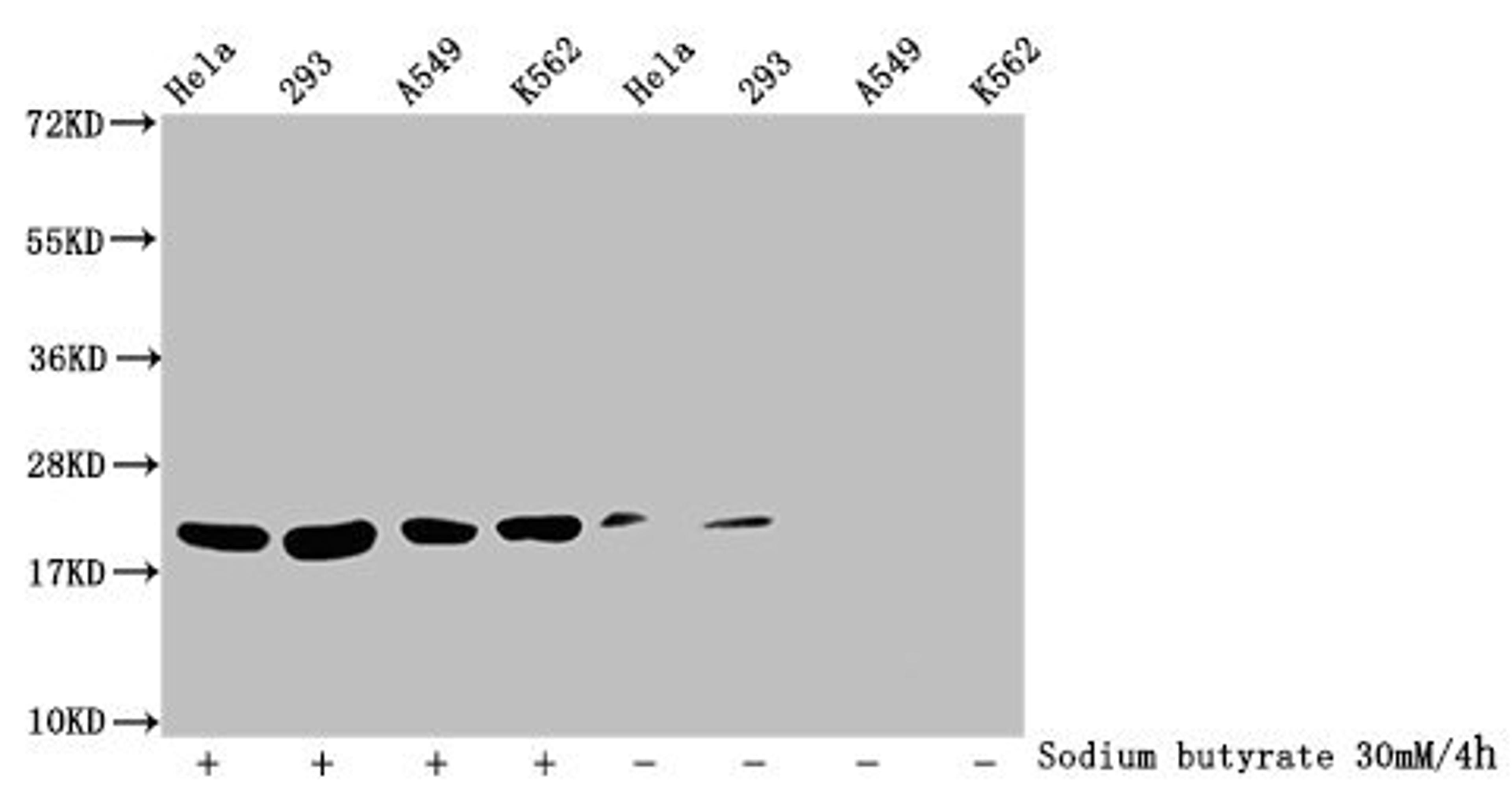 Western Blot. Detected samples: Hela whole cell lysate, 293 whole cell lysate, A549 whole cell lysate, K562 whole cell lysate; Untreated (-) or treated (+) with 30mM sodium butyrate for 4h. All lanes: HIST1H1C antibody at 1:100. Secondary. Goat polyclonal to rabbit IgG at 1/50000 dilution. Predicted band size: 22 kDa. Observed band size: 22 kDa