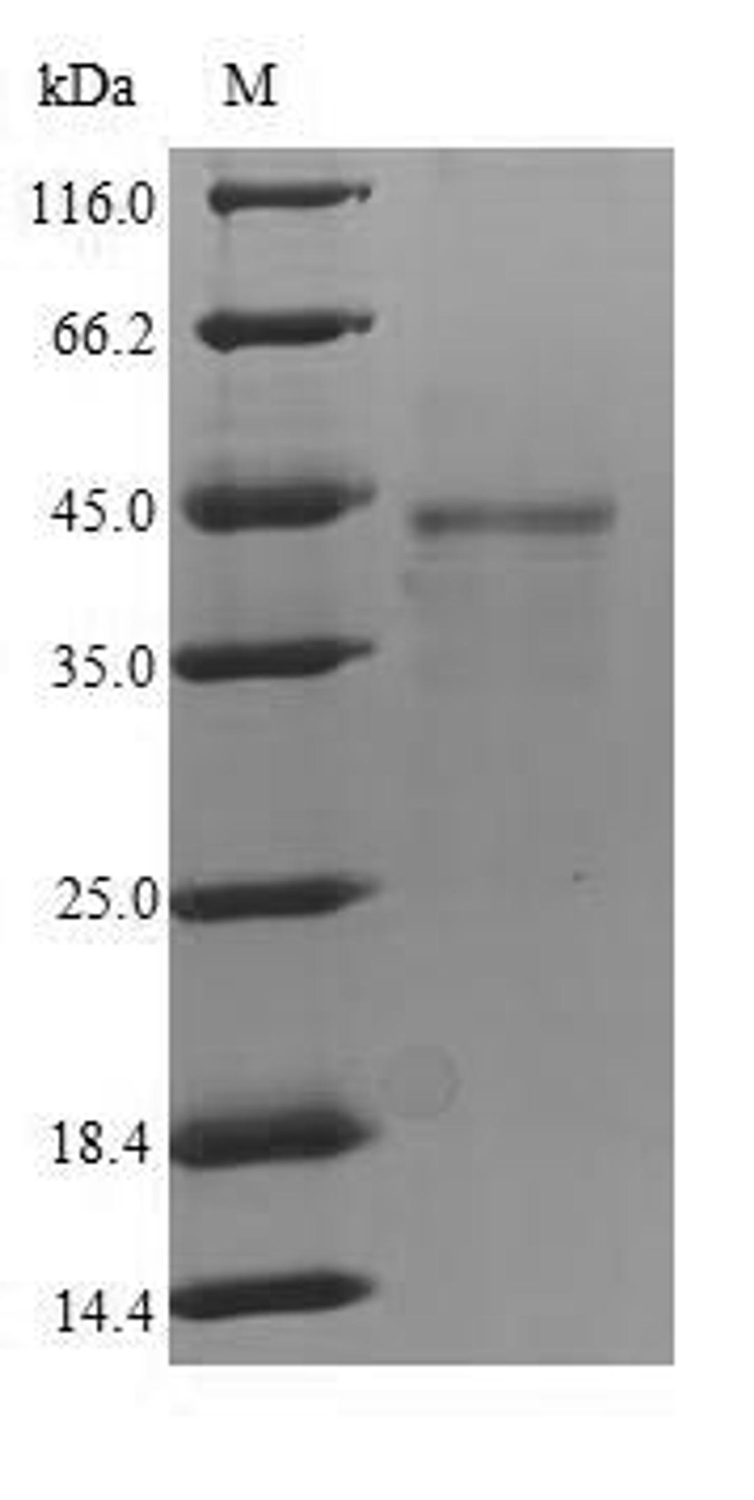 (Tris-Glycine gel) Discontinuous SDS-PAGE (reduced) with 5% enrichment gel and 15% separation gel.