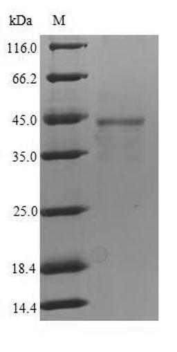 (Tris-Glycine gel) Discontinuous SDS-PAGE (reduced) with 5% enrichment gel and 15% separation gel.